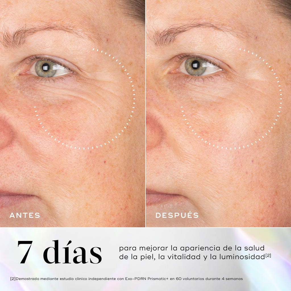 Comparación del antes y después del área debajo de los ojos y de las mejillas de una persona, con un círculo punteado que resalta la mejora en la textura de la piel. Debajo, el texto indica que está clínicamente comprobado que la piel se ve visiblemente más suave y tersa en un 43% en 7 días.