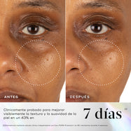 Comparación del antes y después del área externa de los ojos de una persona, con un círculo punteado que resalta una reducción visible de las patas de gallo. Debajo, un texto grande indica “7 días” para revelar una piel de aspecto más saludable, radiante y luminosa.
