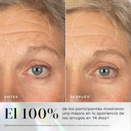 Comparación del antes y después de la frente y el área de los ojos de una persona, con un círculo punteado que resalta una reducción visible de las arrugas en la frente. Debajo, un texto grande indica que el 100% de los participantes notó una reducción visible de las arrugas en 14 días.