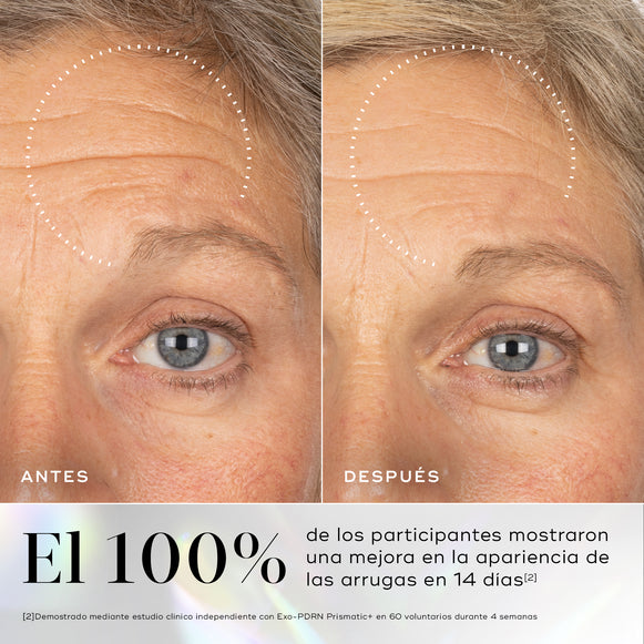 Comparación del antes y después de la frente y el área de los ojos de una persona, con un círculo punteado que resalta una reducción visible de las arrugas en la frente. Debajo, un texto grande indica que el 100% de los participantes notó una reducción visible de las arrugas en 14 días.-hover-3