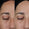 Crystal Retinal®