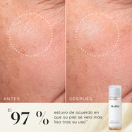 Primer plano de antes y después de la piel de la mejilla de un participante, mostrando una textura más suave y una apariencia más uniforme. La botella del tónico Medik8 Press & Glow aparece en una esquina. El texto destaca que el 97 % está de acuerdo en que su piel se veía más suave después de usarlo.