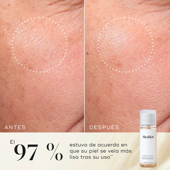 Primer plano de antes y después de la piel de la mejilla de un participante, mostrando una textura más suave y una apariencia más uniforme. La botella del tónico Medik8 Press & Glow aparece en una esquina. El texto destaca que el 97 % está de acuerdo en que su piel se veía más suave después de usarlo.-hover-13