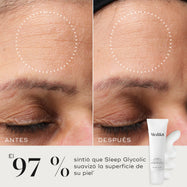 Comparación de antes y después en primer plano de la piel de la frente de un participante, mostrando una textura visiblemente más suave y un aspecto más refinado. En una esquina aparecen el tubo de Medik8 Sleep Glycolic y una muestra de textura de crema blanca sobre un fondo neutro. El texto destaca: «El 97 % sintió que Sleep Glycolic suavizó la superficie de su piel*».
