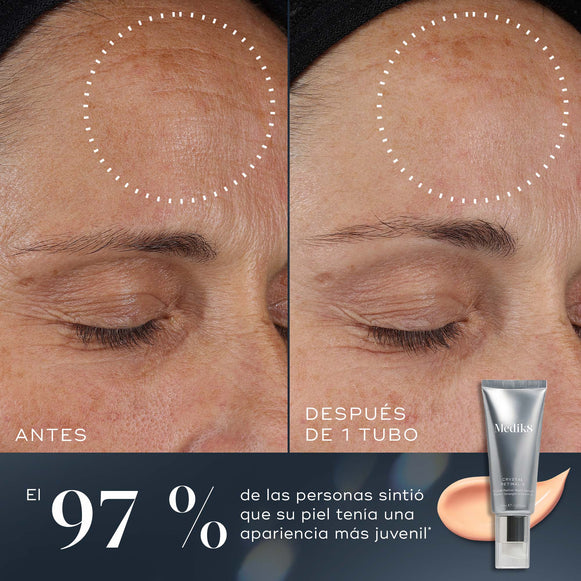 97 % – Comparación de antes y después de la frente de un participante que muestra una mejora visible de la piel tras utilizar un tubo de Medik8 Crystal Retinal. El texto indica: «El 97 % de las personas sintió que su piel tenía un aspecto más juvenil».-hover-1