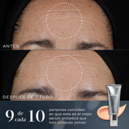 9/10 – Comparación de antes y después de la frente de una persona que muestra una mejora visible en líneas finas y arrugas tras utilizar un tubo de Crystal Retinal. El texto indica: «9 de cada 10 están de acuerdo en que este es el mejor sérum antiedad que ha