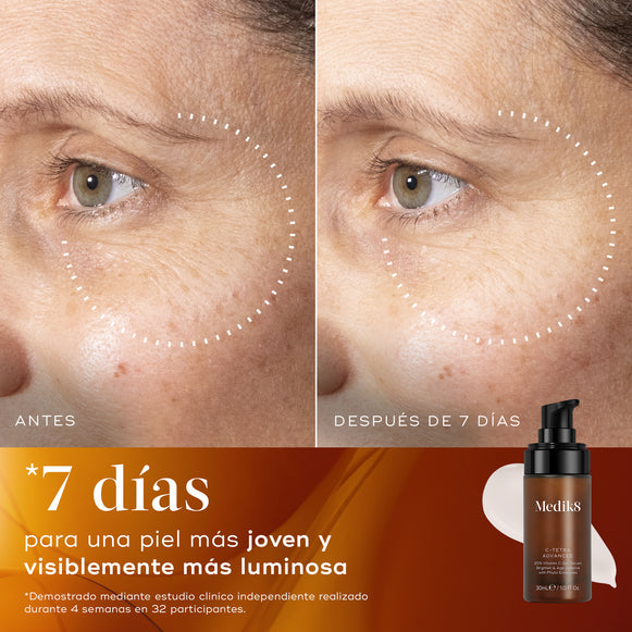 Imagen 2: Comparación de antes y después de la piel de un participante durante 7 días, mostrando una piel visiblemente más luminosa, con mayor resplandor y un tono más uniforme.

Imagen 3: Primer plano comparativo de antes y después de la piel de un participante durante 7 días, mostrando una textura de la piel visiblemente más suave y una apariencia más refinada.-hover-7