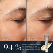 Comparación de antes y después del área de los ojos de una persona que muestra una mejora en la apariencia de las arrugas alrededor de los ojos tras solo un uso. Debajo de las imágenes, el texto indica: «El 94 % mostró una mejora clínica en la apariencia de las arrugas alrededor de los ojos con solo 1 uso».
