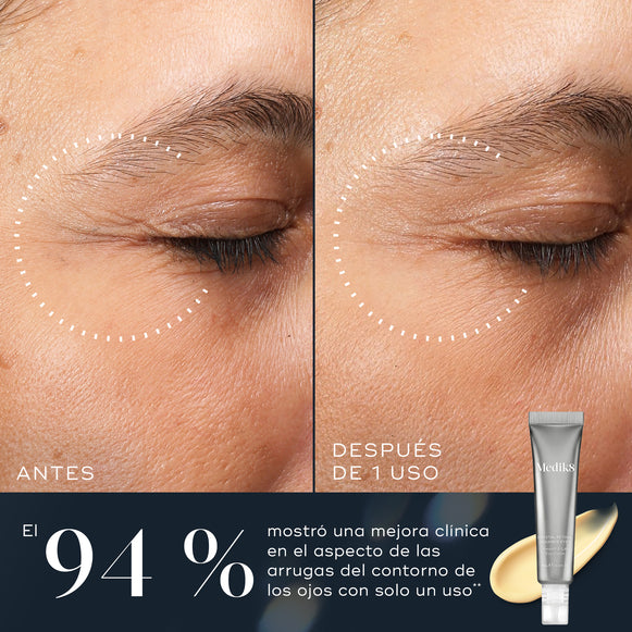Comparación de antes y después del área de los ojos de una persona que muestra una mejora en la apariencia de las arrugas alrededor de los ojos tras solo un uso. Debajo de las imágenes, el texto indica: «El 94 % mostró una mejora clínica en la apariencia de las arrugas alrededor de los ojos con solo 1 uso».
-hover-10